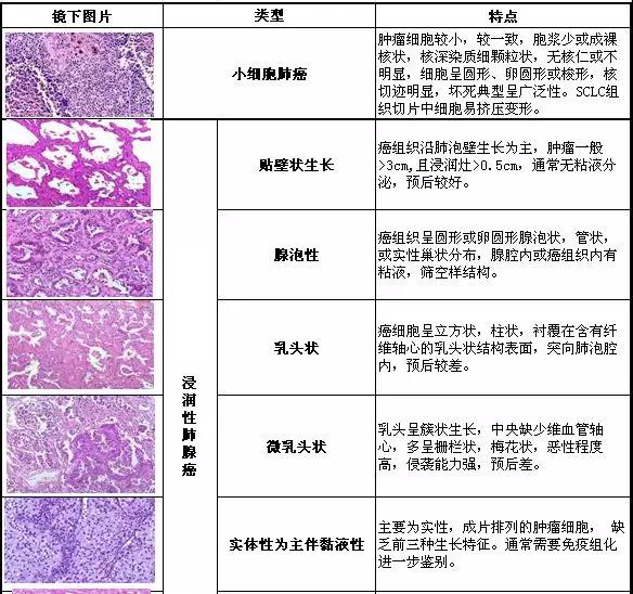 肿瘤免疫组化染色结果