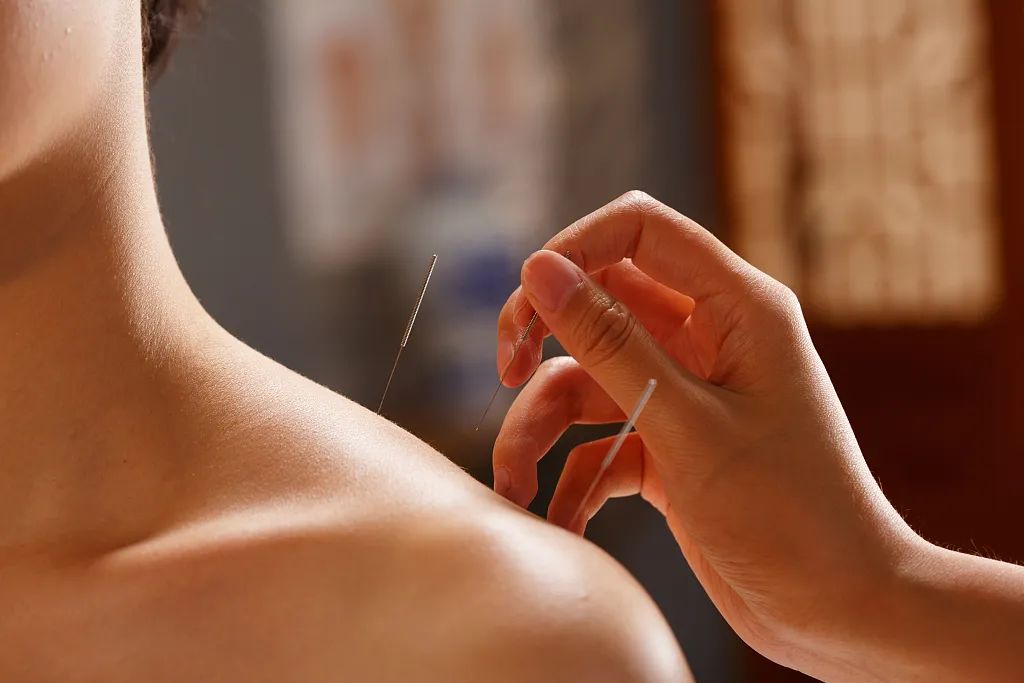 中医针灸