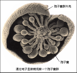 %E8%95%A8%E7%B1%BB%E6%A4%8D%E7%89%A9%E5%AD%A2%E5%AD%90%E5%9B%8A%E6%98%BE%E5%BE%AE%E7%BB%93%E6%9E%84