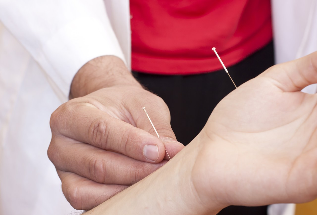 中医针灸治疗过程