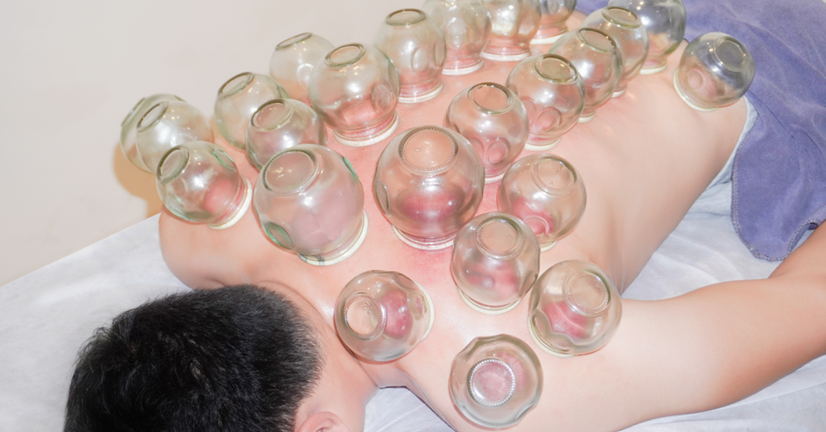 现代健身房中的传统拔罐疗法