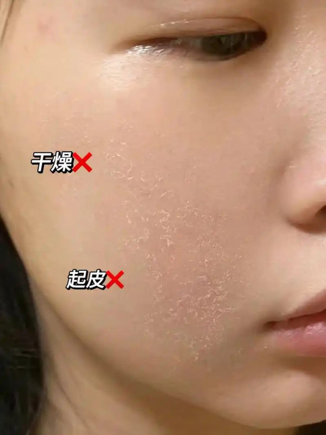 秋冬季节干燥的皮肤特写